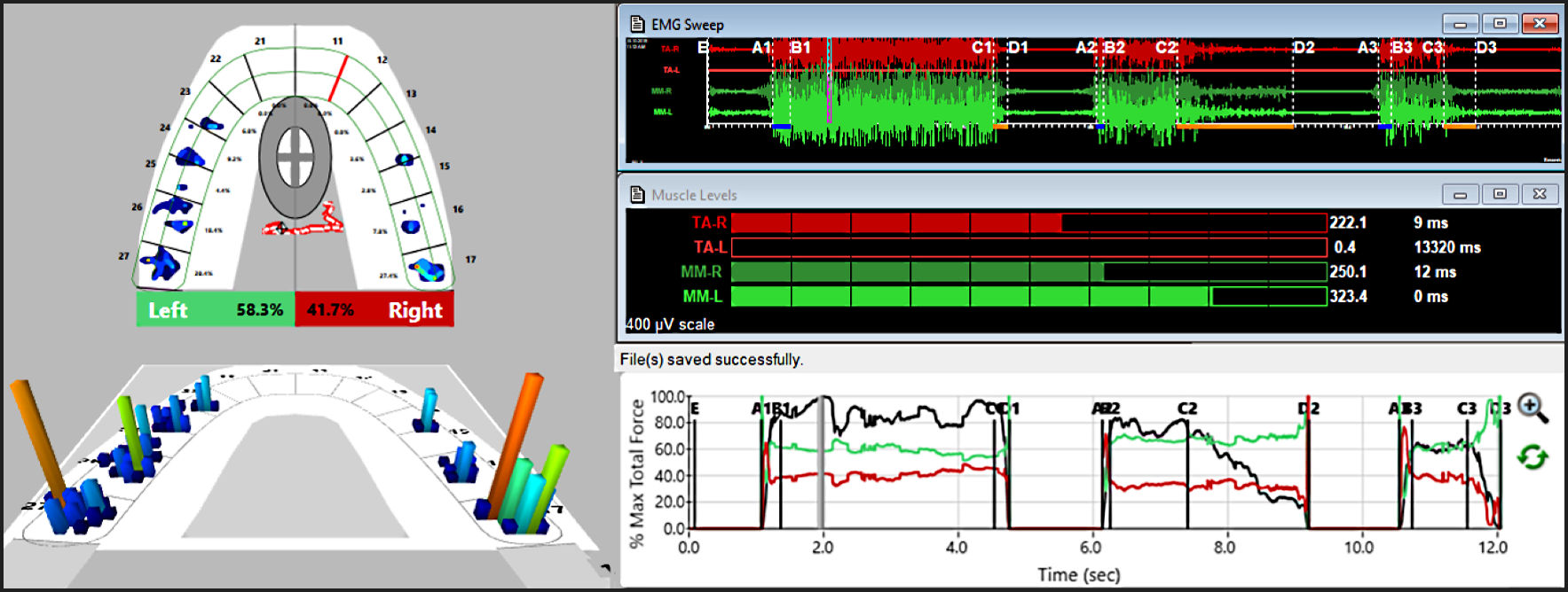 Compression suits with and without films and their effects on EMG